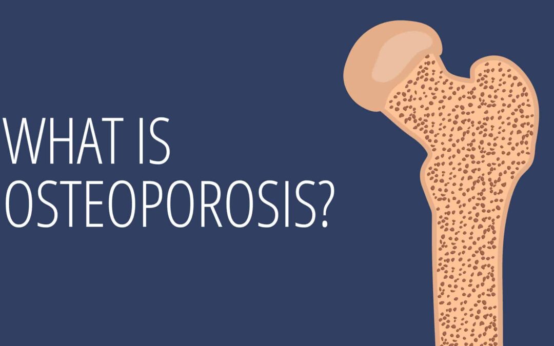 Let’s chat about Osteoporosis